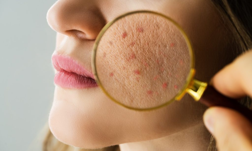 introducing colon hydrotherapy for Connection Between Colon Health and Radiant Skin