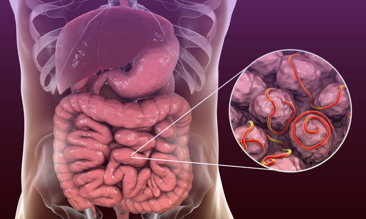 Image illustrating parasites in gastrointestinal tract